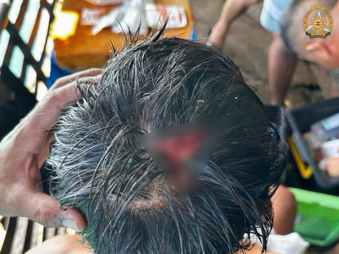 Philippine Navy man hit on the head by Chinese Coast Guard