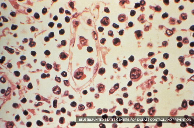 WHO: Risk of hantavirus spread remains low