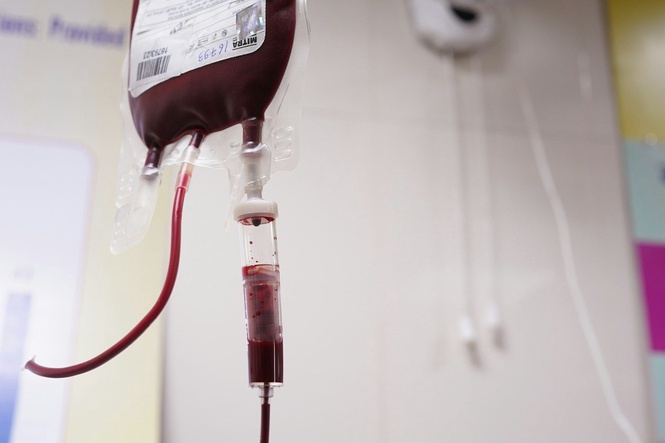 New Blood Thinner Might Slow Down Cognitive Decline in Alzheimer’s Patients With AFib