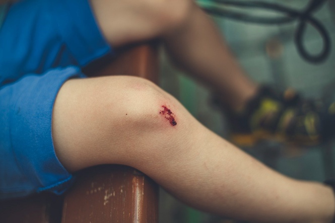 When Teenage Knee Pain Could Signal Bone Cancer