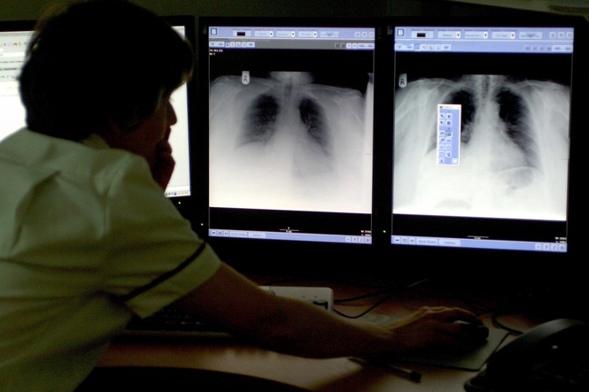 New dual-action drug a ‘promising step forward’ for patients with hard-to-treat lung cancer