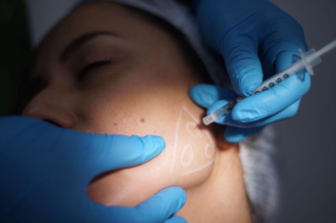 ‘I had 12 vials of Botox injected into my face at age 24 – but it had nothing to do with looks’