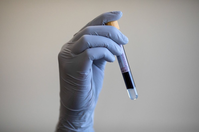Blood test could revolutionise the way Alzheimer’s is diagnosed