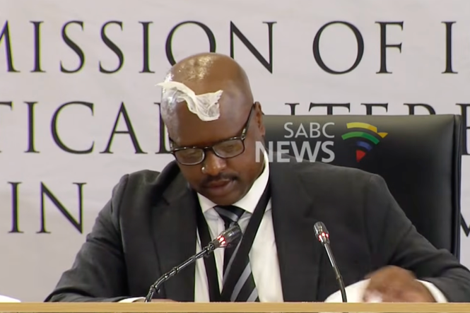 Ex-police chief gets tissue stuck on forehead during corruption inquiry