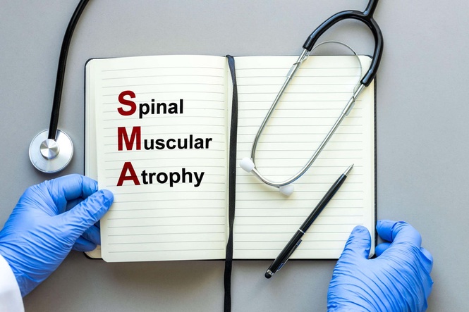 5 early signs of SMA for parents to look out for
