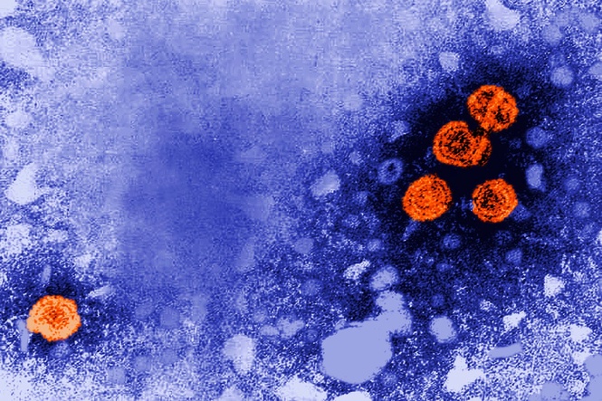 FDA fast-tracks promising hepatitis B drug after ‘remarkable’ trial results