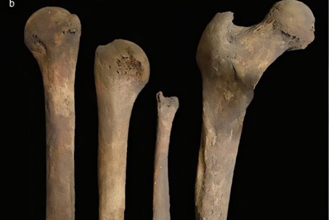 Iron Age Britons likely removed corpse brains in strange funeral ritual