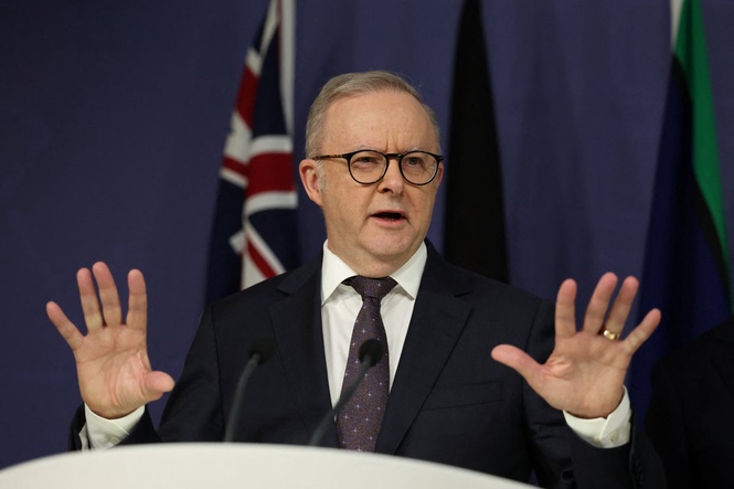 Voices: Albanese didn’t slip up with his Kylie comments – he told us exactly what he thinks of women