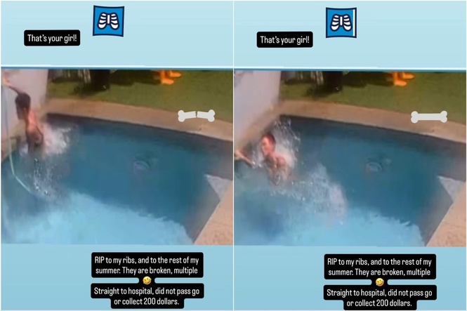 Netflix star shares footage of horror accident which left them hospitalised