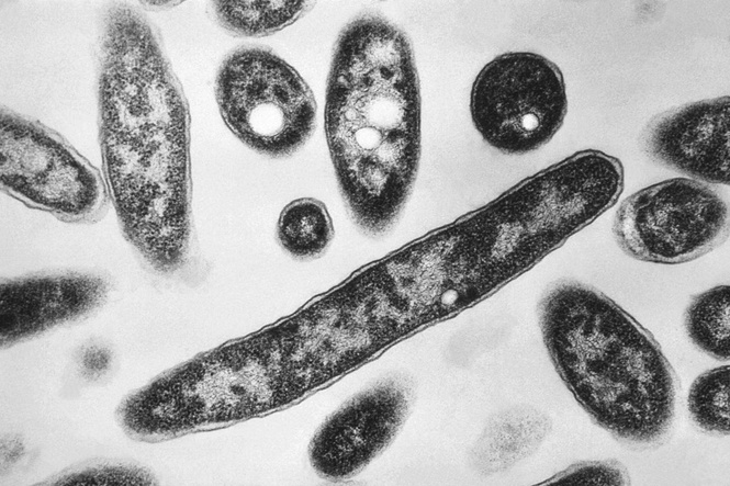 First death reported in Legionnaires' disease outbreak in New York City