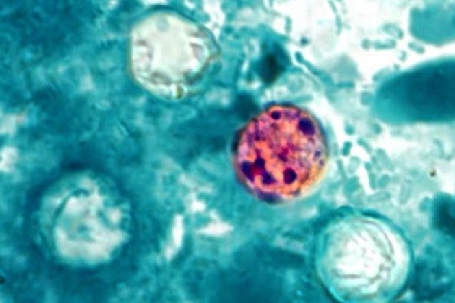 Parasite that causes ‘explosive diarrhea’ has infected over 1,000 in 17 states - here is how to stay safe