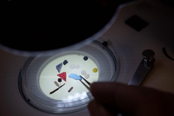High levels of microplastics found in heart attack survivors