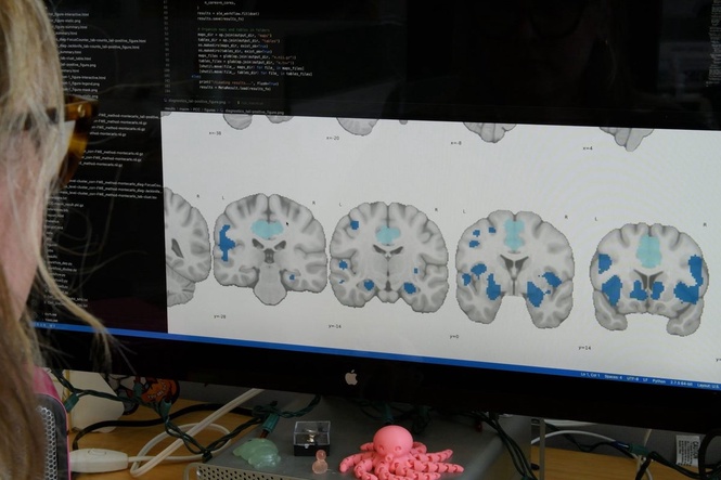 Poor sleep is doing more than making you tired – it’s changing the way your brain works