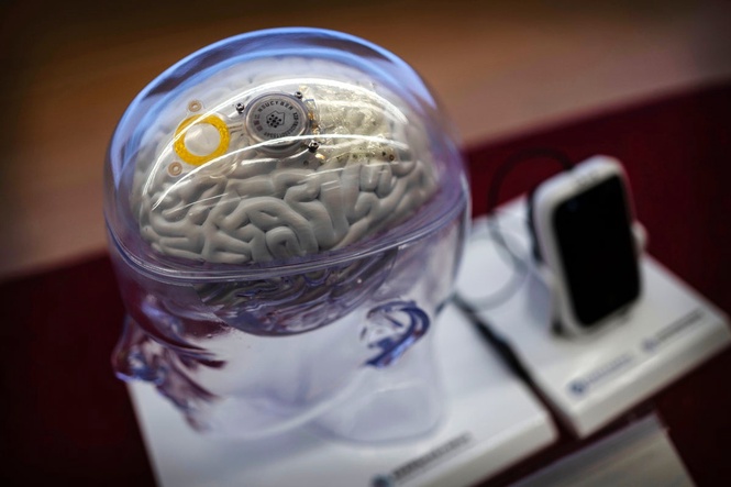 China approves brain chip devices to rival Elon Musk’s Neuralink