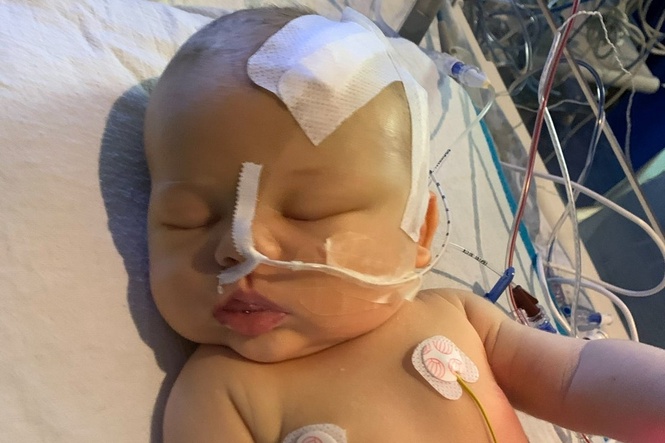 Newborn diagnosed with brain tumour after doctors spot tiny detail on fingernail