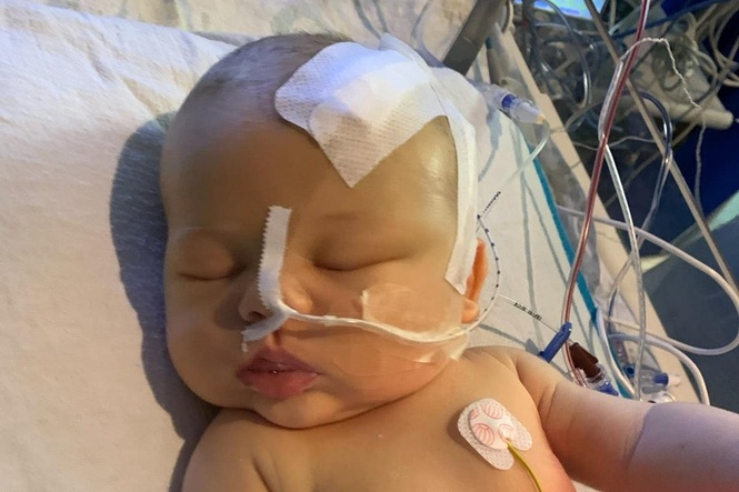 Mother tells how nail infection led to diagnosis of baby son’s brain tumour
