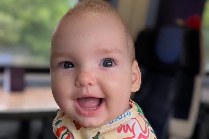 Baby boy with rare condition given world-first treatment involving ‘super-elastic springs’ to reshape skull