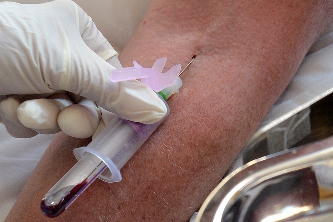 Six-hour sepsis test identified infection days before conventional methods