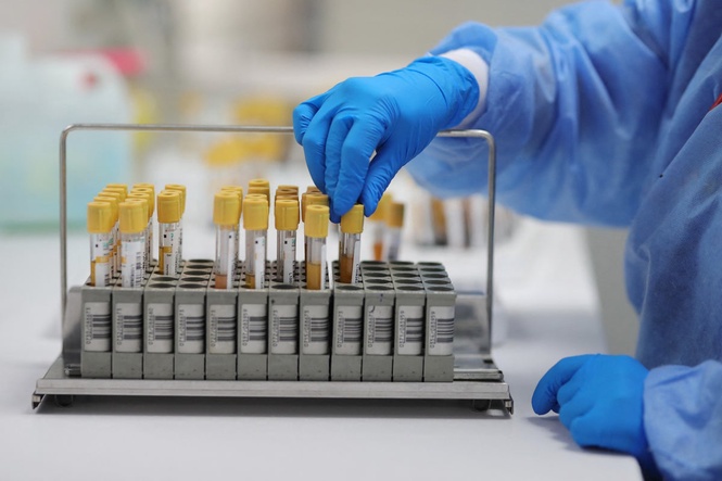What is PFOA? Cancer-causing ‘forever chemical’ found in people living near factory