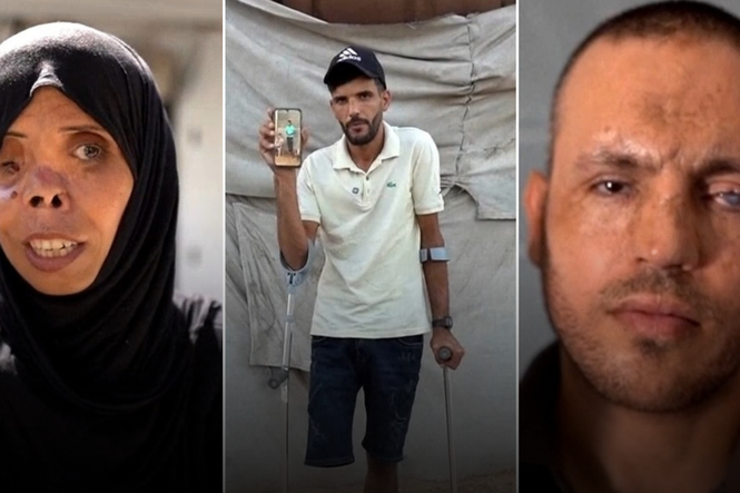 How life-changing war injuries have transformed people in Gaza