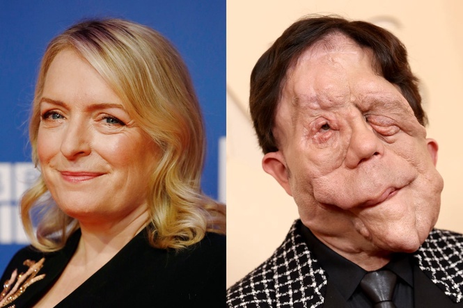 Claire Rushbrook and Adam Pearson join The Independent and ICA London’s Free Thinkers film festival