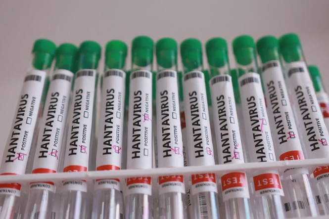 Image from: Penang tightens monitoring at entry points over hantavirus risk