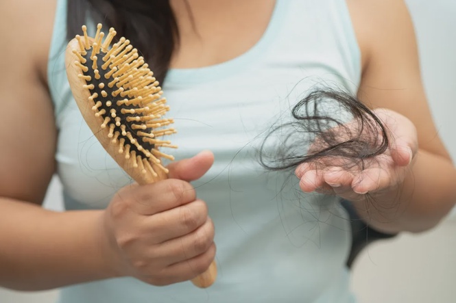 Image from: Fixing, addressing hair fall for women