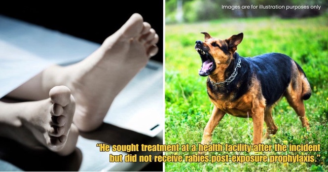 “First case since 1998” – 31yo Kedah Man Dies From Rabies After Being Bitten By Stray Dog