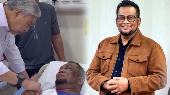 Image from: Cedera motosikal bertembung kereta, Nash kena 52 jahitan