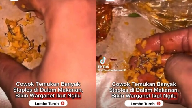 Image from: Terkejut jumpa banyak dawai kokot dalam nasi