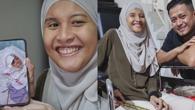 Image from: Buta Selepas Kemalangan, Masitah Belajar Erti Kebahagian Sebenar