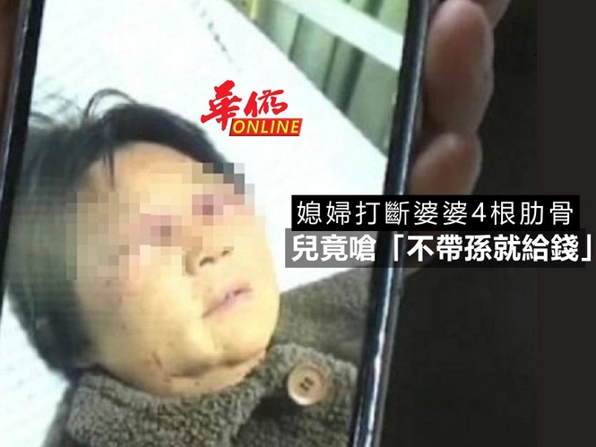 媳婦打斷婆婆4根肋骨 兒竟嗆「不帶孫就給錢」