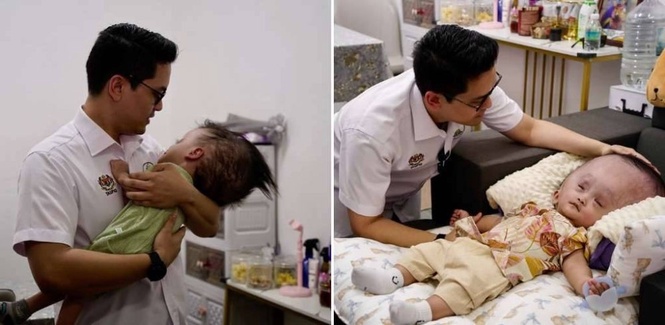 Image from: 'Sebak depan mata…' – Kisah dua beradik hidap hydrocephalus sentuh hati Dr Taufiq Johari, ambil Rayhan & Mateen jadi anak angkat