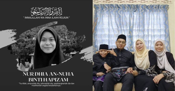 Image from: '2 hari di hospital sebelum pergi selamanya...' Gusi berdarah, mudah lebam rupanya tanda anak leukemia, bapa terkilan tak sedar awal