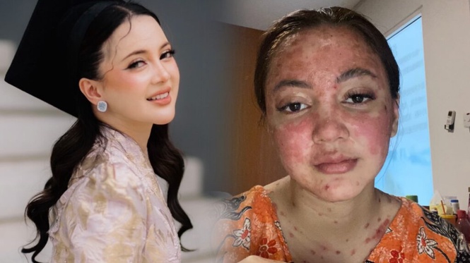 Image from: Pernah hilang semangat hidup, tidak keluar rumah dua bulan – Sharmaine Alexander