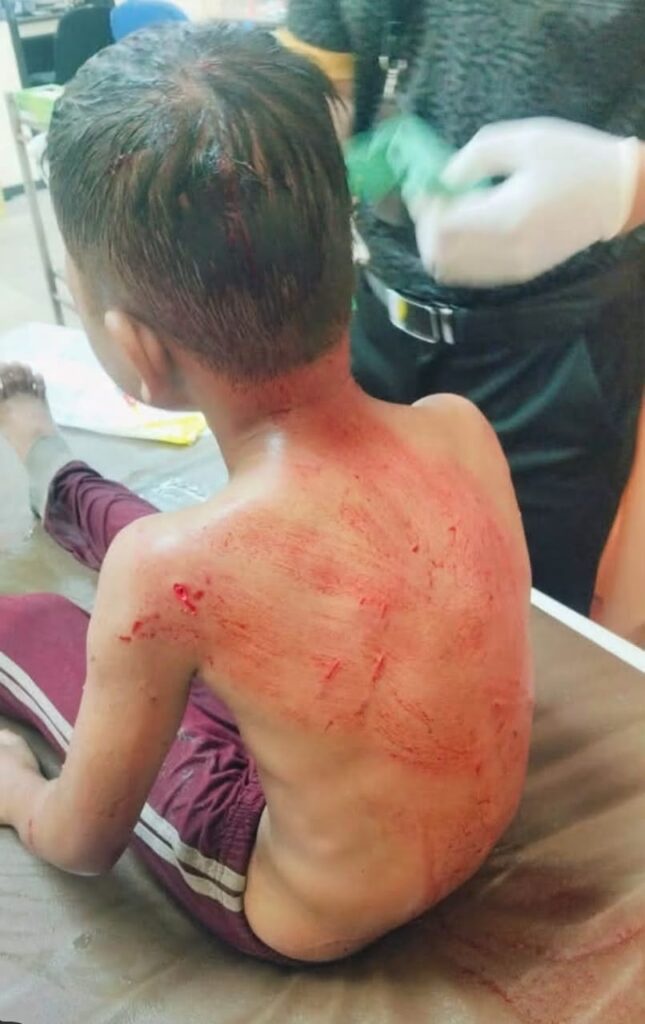 Image from: Budak cedera diserang anjing liar di Pantai Kuala Kemasin